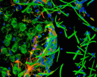 Microscopía confocal 3D que muestra la red de fibras interactuando con el cerebro del ratón.